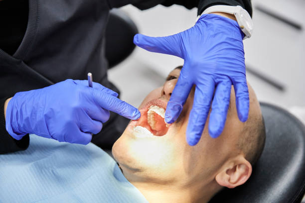 Best Emergency Dental Care for Broken or Chipped Teeth in Elk City, OK