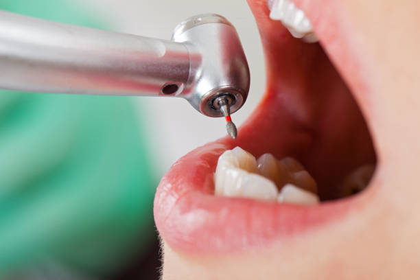 Best Emergency Denture Repair in Elk City, OK